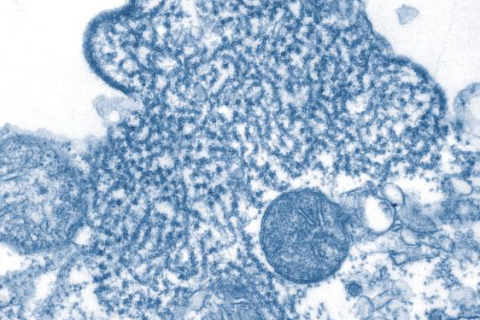 Ministério da Saúde faz comunicado sobre o Vírus Nipah no Brasil após o Carnaval.